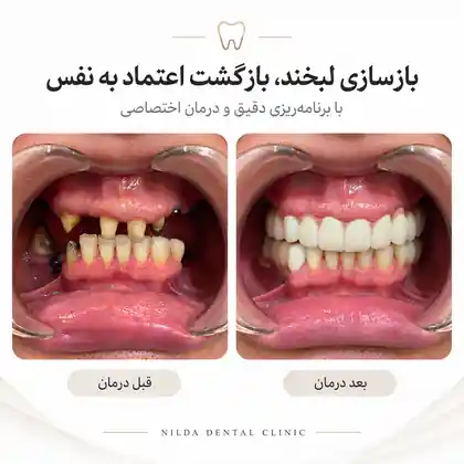 نمونه قبل و بعد نیلدا — کیس ۰۰۱ — بدون نمایش چهره قابلشناسایی
