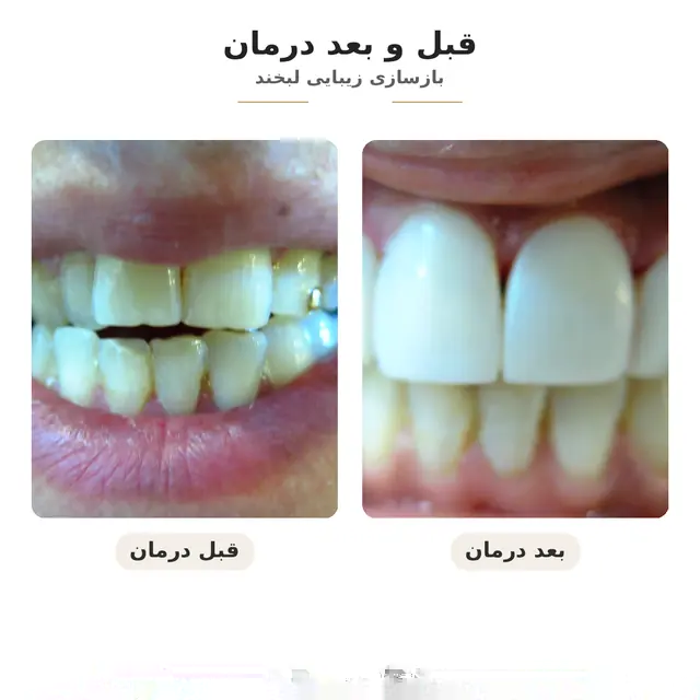 نمونه قبل و بعد نیلدا — کیس ۰۰۶ — بدون نمایش چهره قابلشناسایی