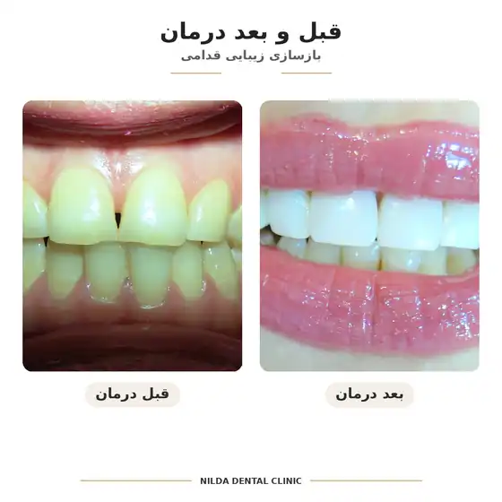 نمونه قبل و بعد نیلدا — کیس ۰۰۷ — بدون نمایش چهره قابلشناسایی