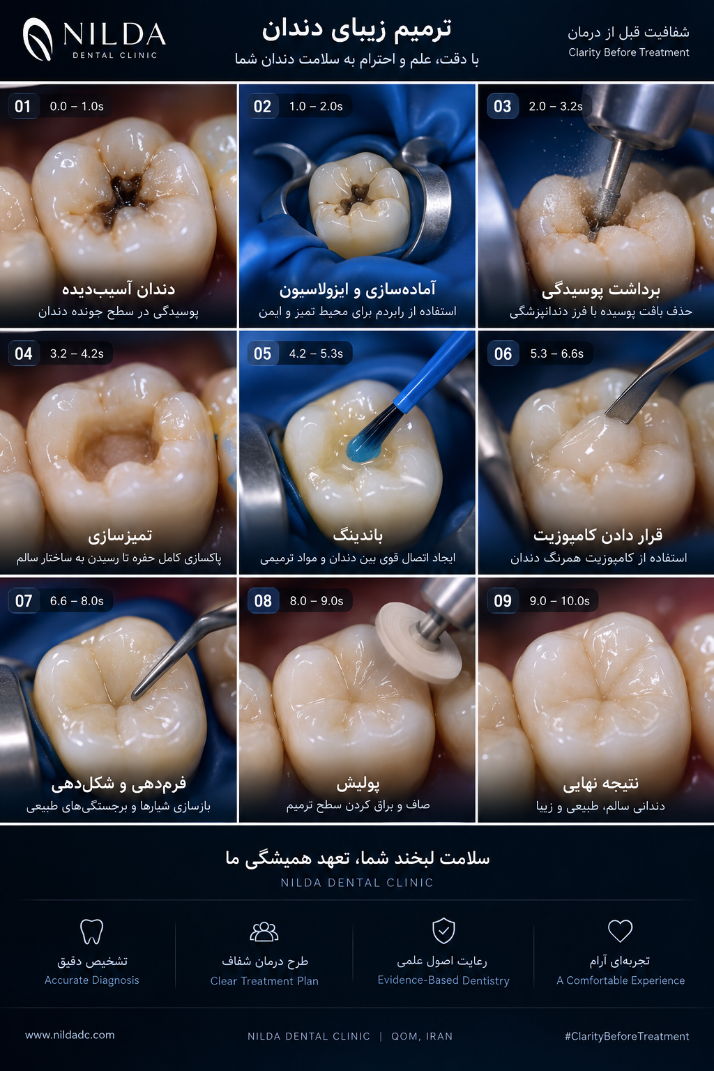 Educational overview of restorative dentistry and composite restoration stages